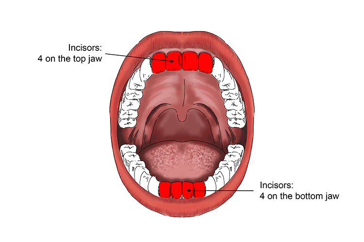 Image of the mouth showing 8 incisors